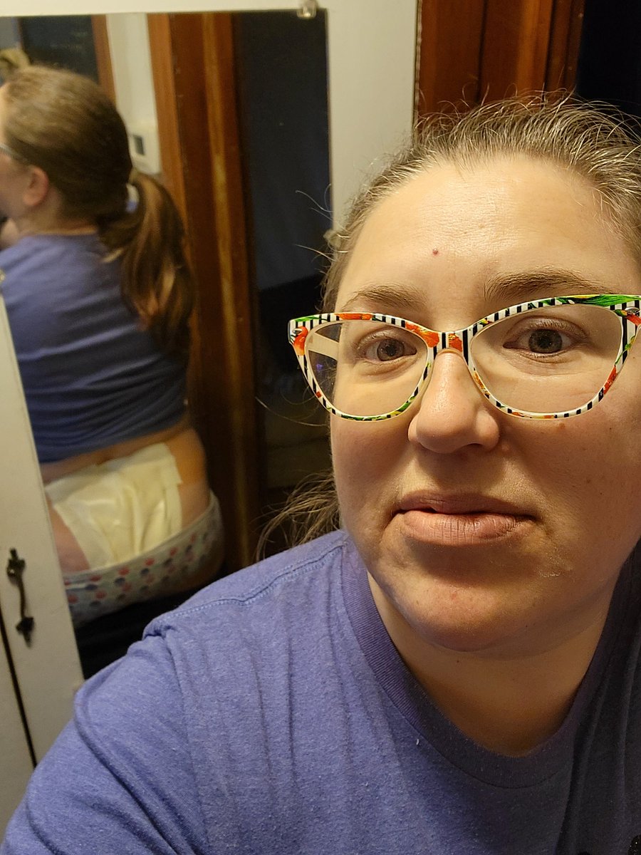 ladybugzy's tweet photo. Surgery went well. Recovery is gonna suck. Prayers please
#pilonidalcysts #healthmatters #noshame https://t.co/R4KUTUS7H4
