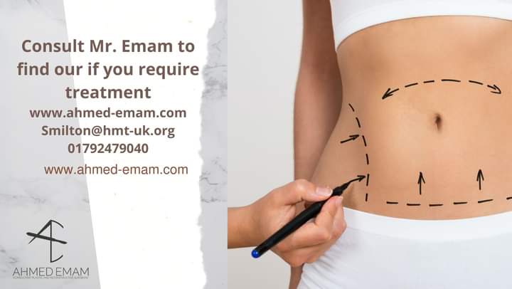 Ahmed Emam (MBBCh, MSc, MRCS, FEBOPRAS, FRCSPlast) (@ahmedeplastics) on Twitter photo A Tummy tuck (aka abdominoplasty) offers many benefits including eliminating excess skin and 
fat, tightening loose muscle and creating a smoother younger appearance A Tummy tuck (aka abdominoplasty) offers many benefits including eliminating excess skin and 
fat, tightening loose muscle and creating a smoother younger appearance