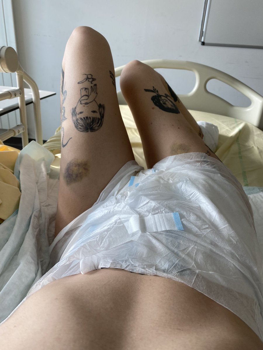 Myarmsbendback_'s tweet photo. Donc. Je porte une couche 😅. 
A 32 ans 😅
On adore. https://t.co/k9zd6KWrqG