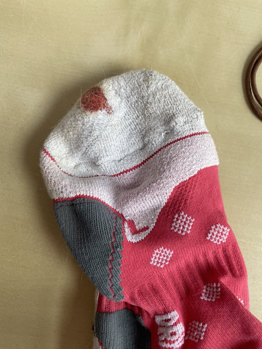 jenthedietitian's tweet photo. I officially have runners feet !! 13.1 miles β¦ I got a shock when I took my trainers off. Must check nails more frequently! π @UKRunChat #run #InternationalWomensDay #RunningAMarathon #running https://t.co/LELF0xNLJS