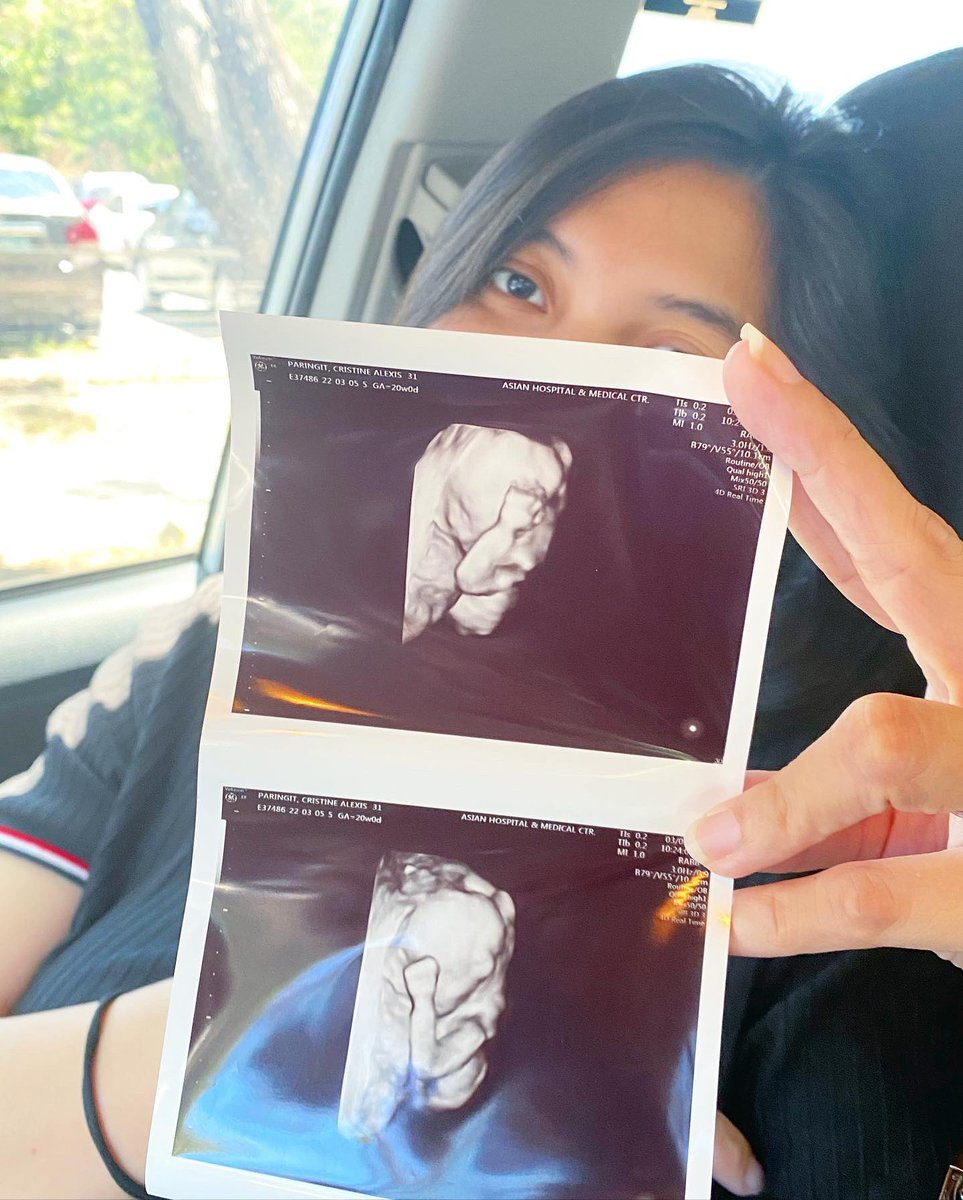 iamviiiiin's tweet photo. OUR NEXT CHAPTER OF OUR LIFE…
She is PREGNANT and our baby is coming this July 2022.
We are so excited and grateful.
Thank you Tin all your sacrifices, literally. I love you both.
Thank you also to our family and friends who supported us on this journey…🙏🏼
#20thweek #blessed https://t.co/b5Apd0Eoek