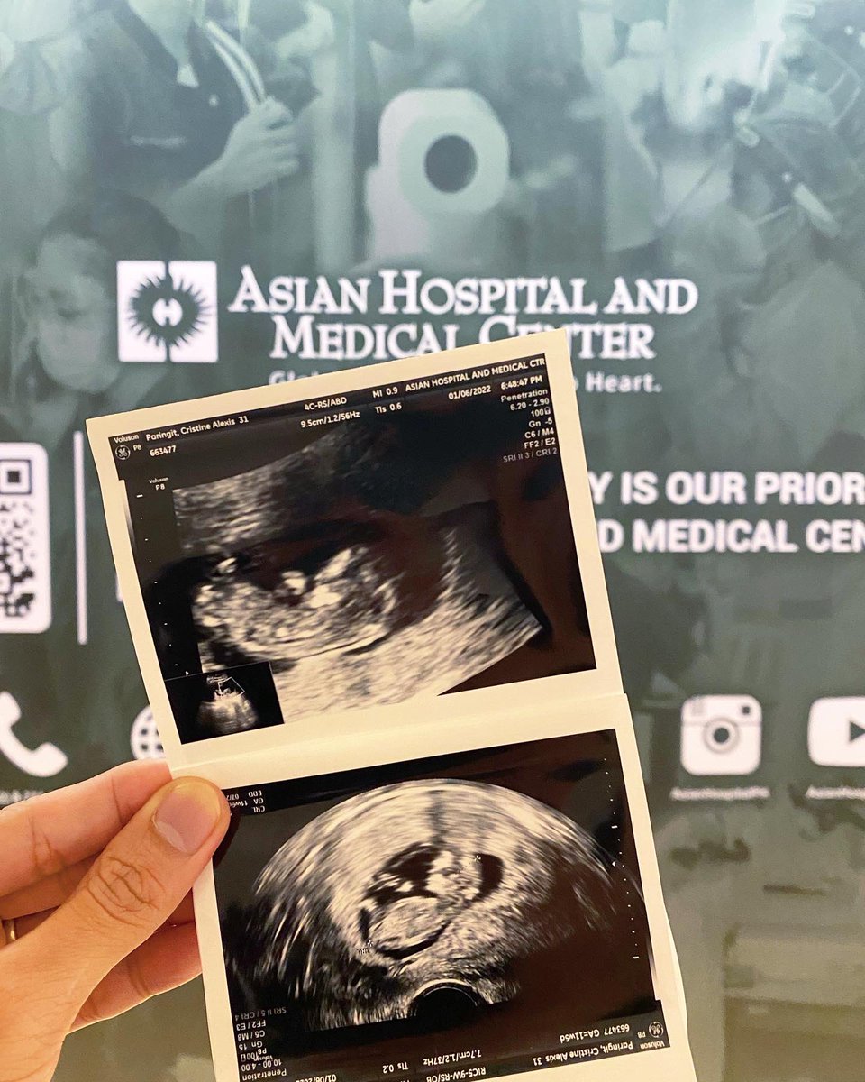 iamviiiiin's tweet photo. OUR NEXT CHAPTER OF OUR LIFE…
She is PREGNANT and our baby is coming this July 2022.
We are so excited and grateful.
Thank you Tin all your sacrifices, literally. I love you both.
Thank you also to our family and friends who supported us on this journey…🙏🏼
#20thweek #blessed https://t.co/b5Apd0Eoek