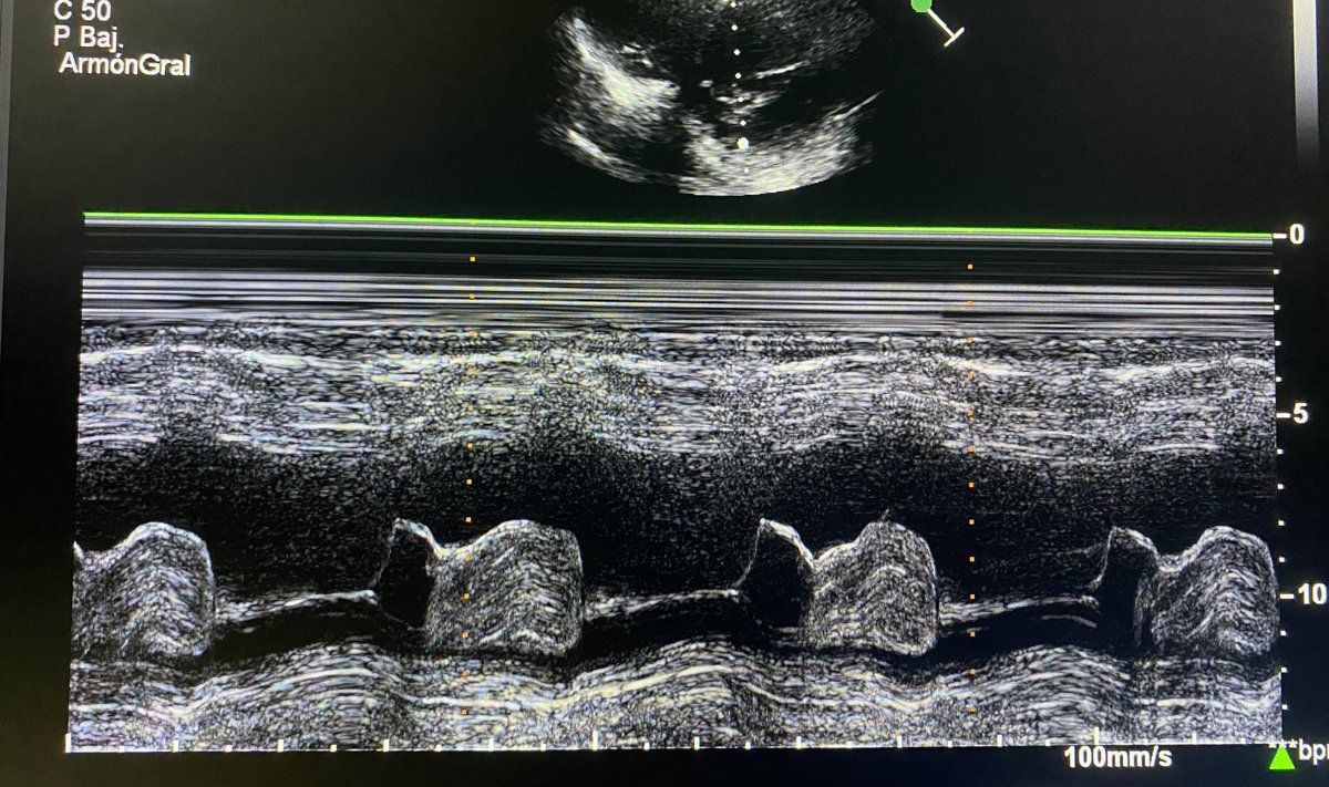 | Daniel Sierra LM | tweet media