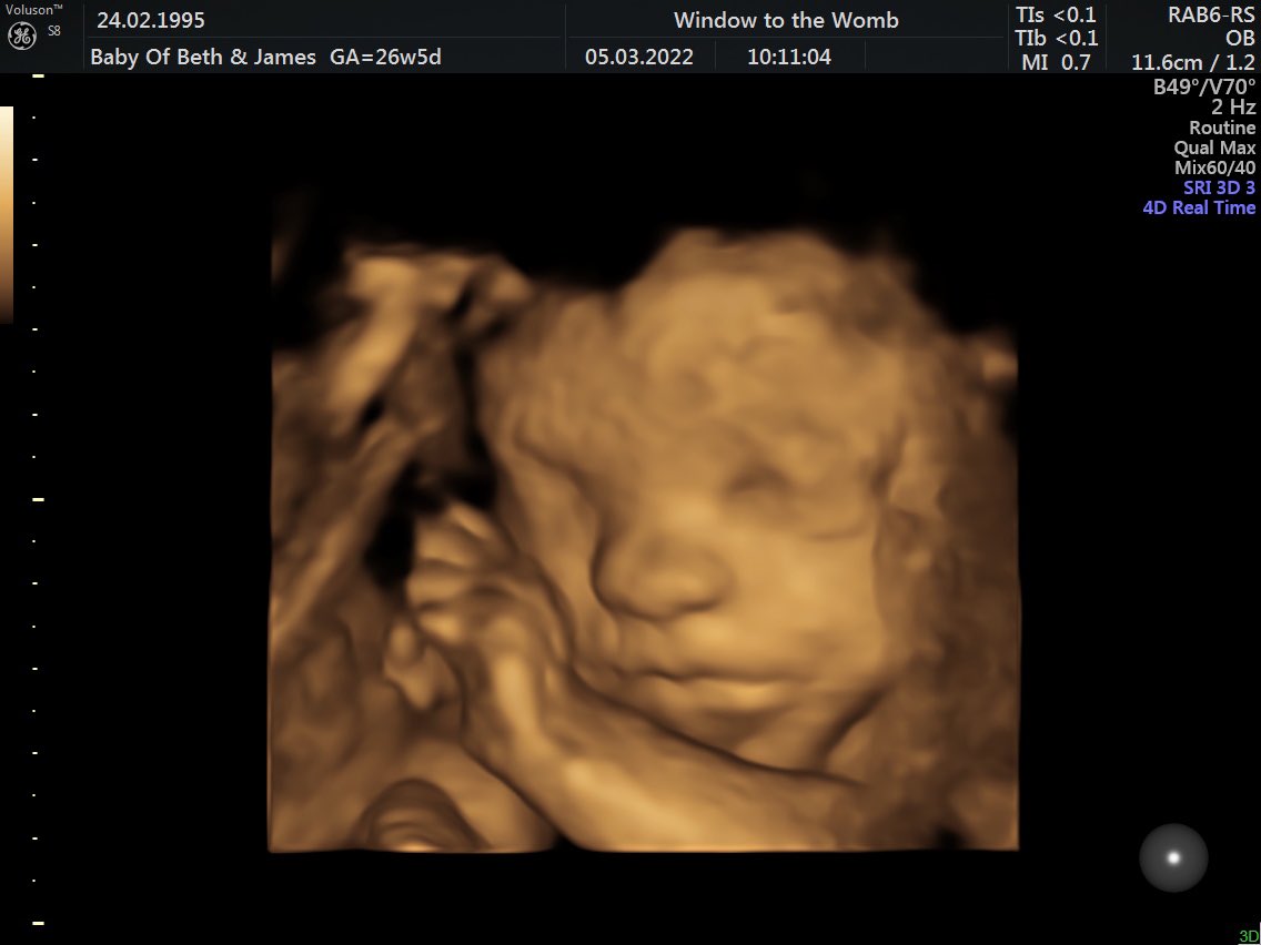 BethLuxton21's tweet photo. Our little boy all snuggled up 💙 https://t.co/BsoOMZzAwo