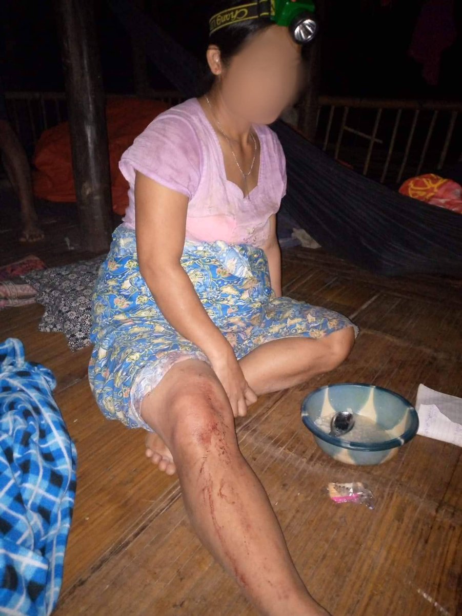 karenwomenorg's tweet photo. Yesterday at 7:20 PM, the military junta based in Hpa-An, Karen State shelled artillery into Klaw Day Village, Mae Klaw village tract, Butho Township, Mutaw District.
Four villagers were struck and seven died immediately. One is in critical condition. https://t.co/vFqiTEgoyx