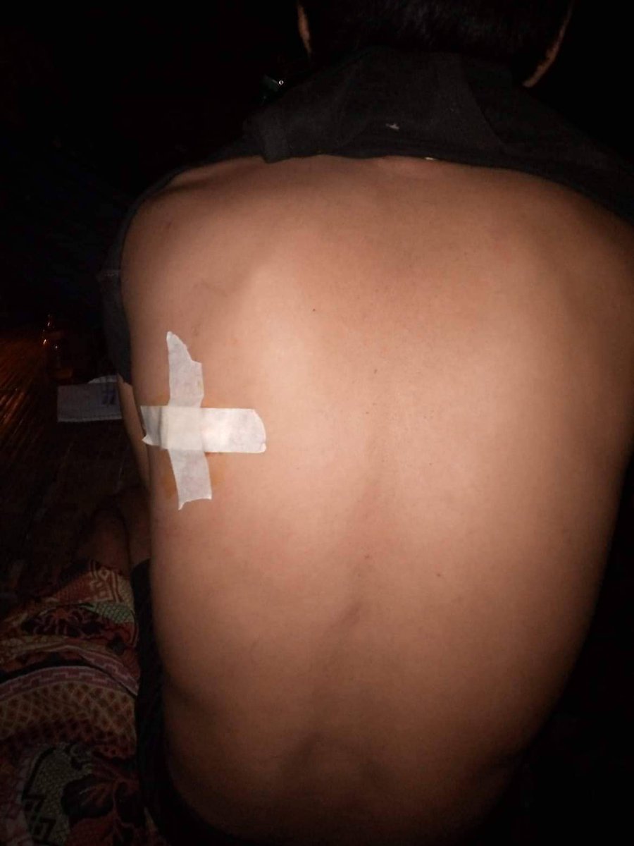karenwomenorg's tweet photo. Yesterday at 7:20 PM, the military junta based in Hpa-An, Karen State shelled artillery into Klaw Day Village, Mae Klaw village tract, Butho Township, Mutaw District.
Four villagers were struck and seven died immediately. One is in critical condition. https://t.co/vFqiTEgoyx