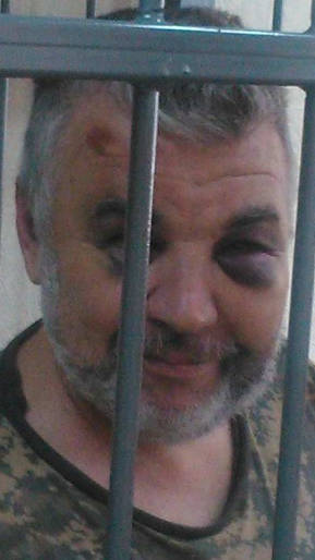 Экс-проректор Международного славянского университета Харькова, профессор Самойлов был арестован СБУ за то, что он что-то не так, с их точки зрения, сказал

В ходе следствия, в тюрьме его избивали, сломали челюсть. И каждый день били по сломанной челюсти, чтобы она не заживала!