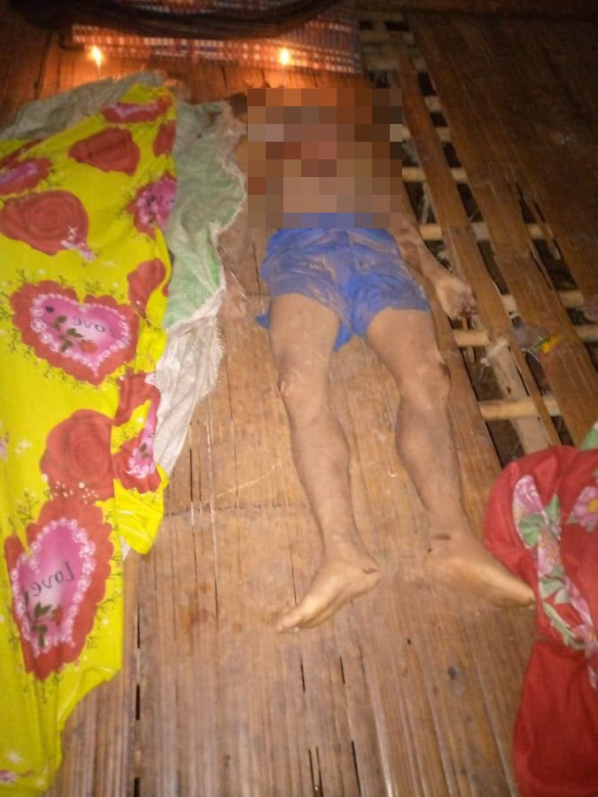 Treza992's tweet photo. KPSM stated that 7 local residents including a 2 yo child and a pregnant woman died and 4 including a 3 yo child got severely injured due to the shelling of artilleries by junta troops last night. #2022Mar6Coup #WhatsHappeningInMyanmar https://t.co/EvDtX43Ij7