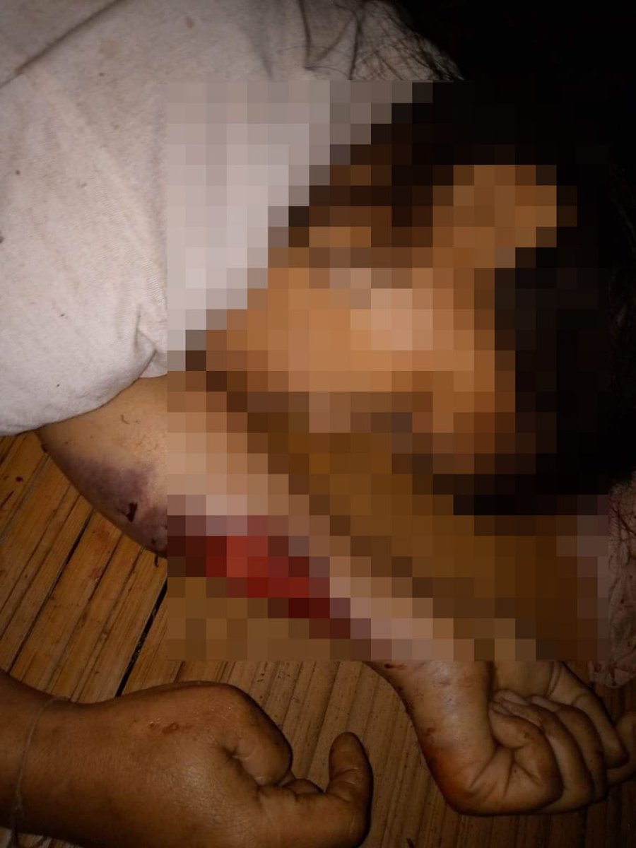 Treza992's tweet photo. KPSM stated that 7 local residents including a 2 yo child and a pregnant woman died and 4 including a 3 yo child got severely injured due to the shelling of artilleries by junta troops last night. #2022Mar6Coup #WhatsHappeningInMyanmar https://t.co/EvDtX43Ij7