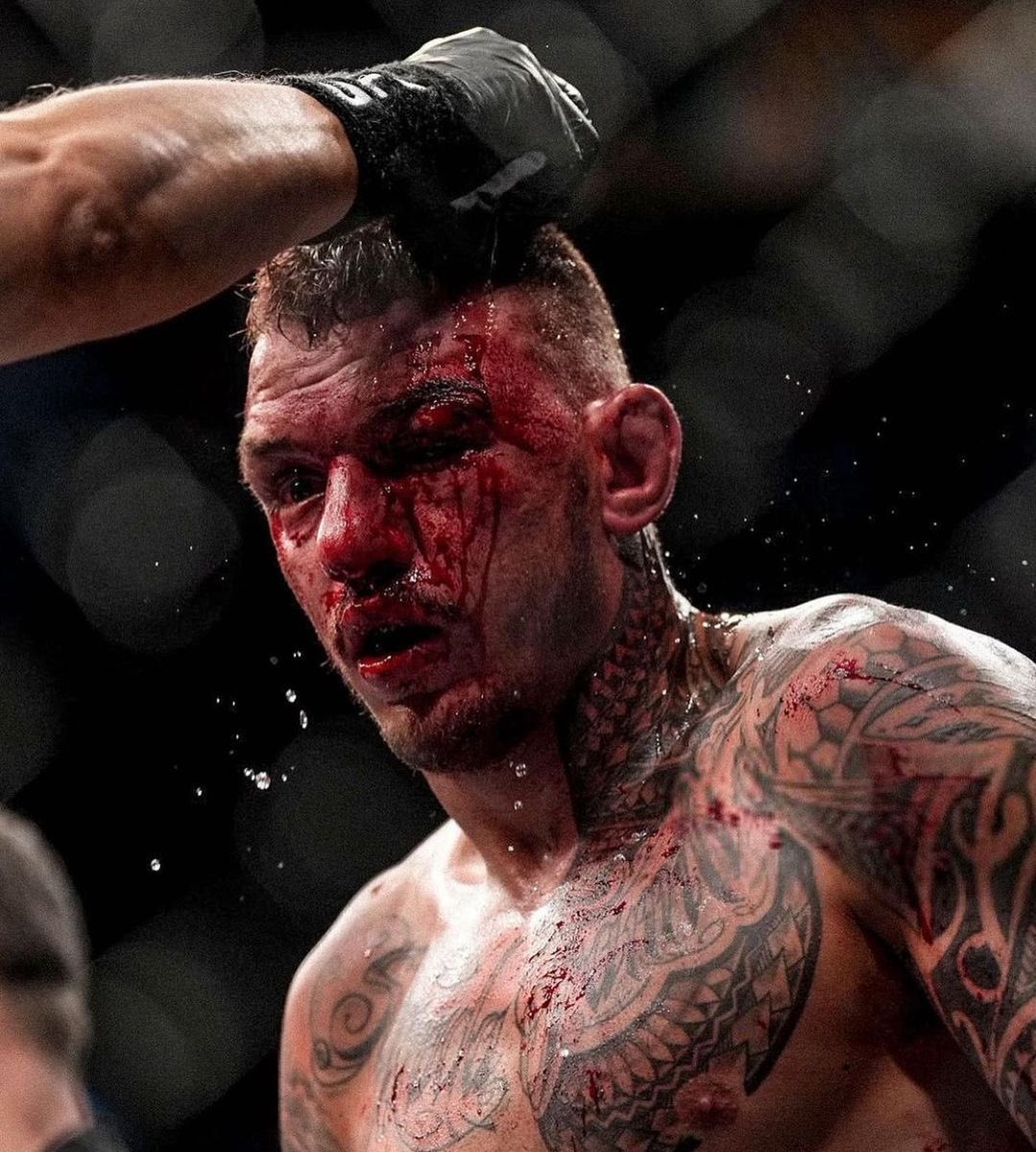 moicanoufc's tweet photo. No excuses, thanks Rafael dos Anjos and @ufc for this opportunity. Today doesn’t define me. I’m victorious in life, the way I handle myself with my family and my team. Thanks God, this is a great time to be alive. Never forget, I’m always chasing the BIG MONEY PORRA! https://t.co/rqKRk3N4MJ