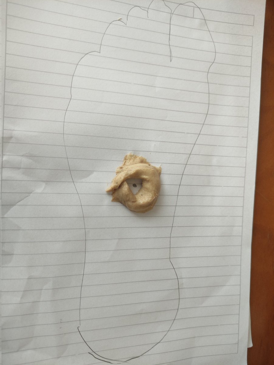 3933Mer's tweet image. Yaparsınız yapmazsınız ama bize küçükken paslı çivi battığı zaman ayağımıza uygulanan buydu,1.resimdeki ayak tabanı, hamur içindeki siyah nokta çivi batan yer, etrafı hamurla çevrilir 2. Resimdeki hamur içindeki görünen tereyağı ufak bir parça olması kâfi 🔽🔽🔽