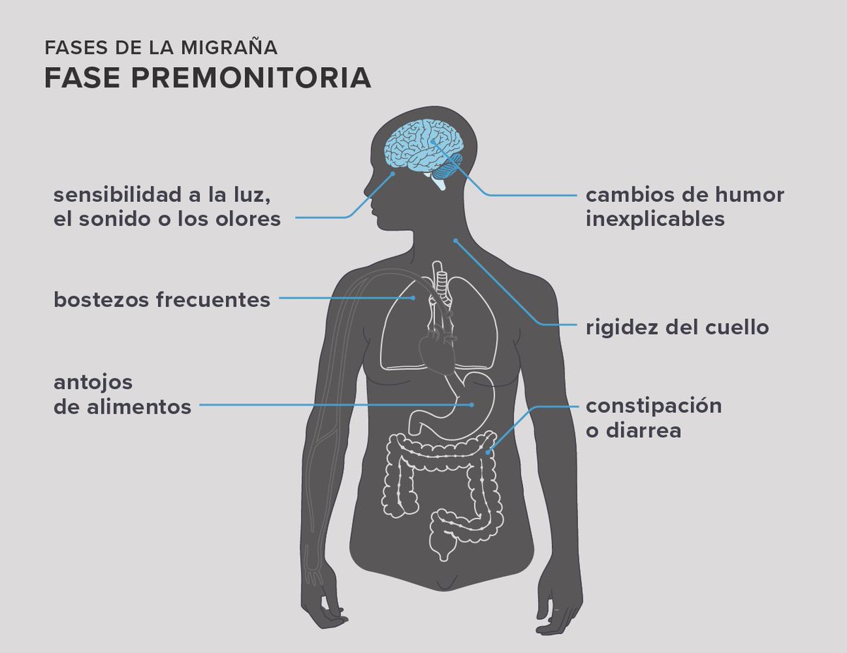 gorka_orive's tweet photo. La migraña afecta a más del 10% de la población, está infradiagnosticada y muchos pacientes no reciben tratamientos disponibles. Un artículo que repasa algunos de los fármacos potencialmente eficaces para la dolencia. https://t.co/ELJy3zo8Z7 https://t.co/8X4MFJelO8