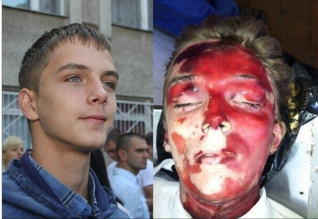 doctormabuse18's tweet photo. Il volto della #Resistenza, l'#eroe aggredito da #criminali, il #martire.
A sinistra quello che col suo predecessore l'ha fatto massacrare con donne (#stuprate) e anziani nel 2014 nella Casa dei Sindacati ad #Odessa e ha proseguito a #bombardare il #DONBASS. https://t.co/Ae1vBYoFna