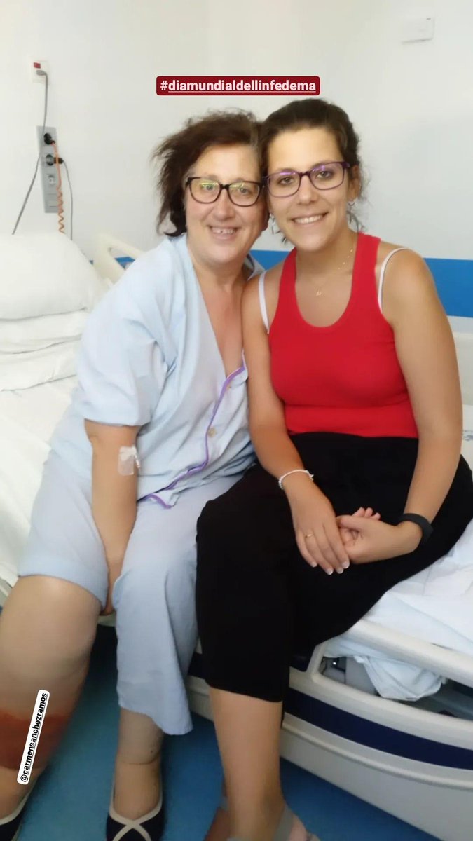 #diamundialdellinfedema por un poro de la piel le entró una bacteria y bueno podéis ver esta foto cuando estaba ingresada por ese motivo <a href="/CarmenCuidadora/">Carmen Cuidadora</a>