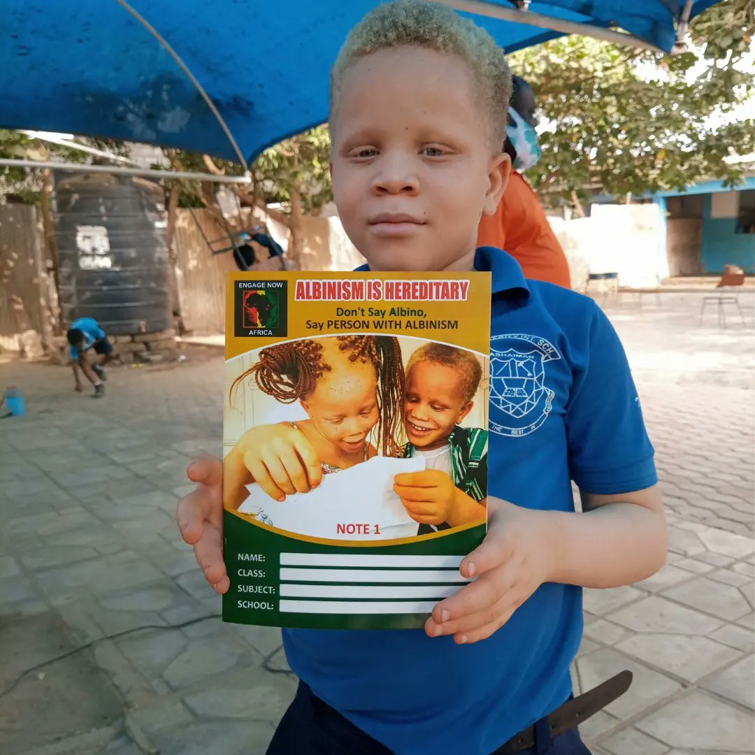 AfricaAlbinism's tweet photo. Don't say "albino' (s)
Say 'person (s) with albinism'
#africaalbinism
#namefirst
Photo Credit: Engage Now Africa GH https://t.co/K9lwae0xNw