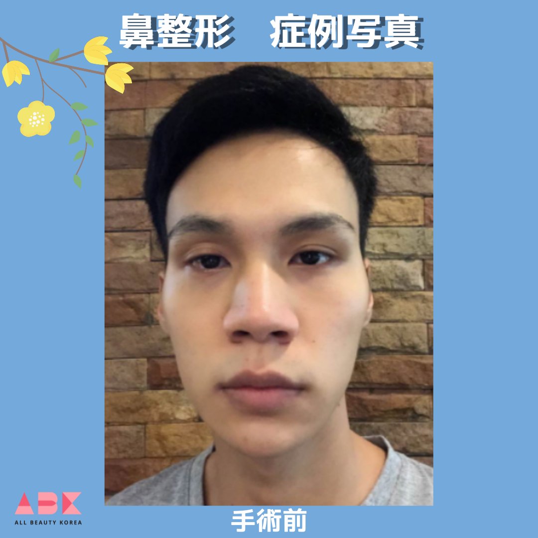 男整形 Twitter Search Twitter