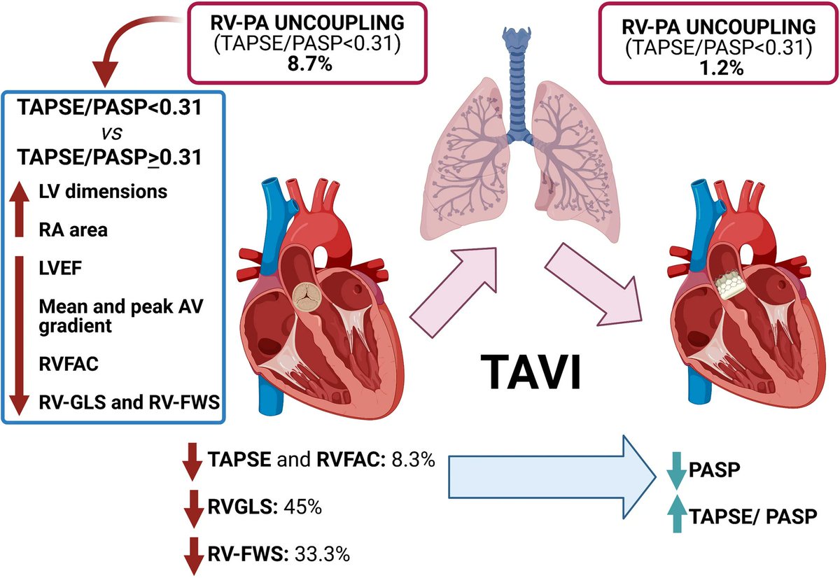 Rosa Lillo (@rosalillo14) on Twitter photo RV systolic function and RV-PA coupling in patients with severe aortic stenosis and the early impact of TAVI
➡️read more 🫀🫁➡️
link.springer.com/article/10.100…
<a href="/FGraziani_Grace/">francesca graziani_FG</a> <a href="/BURZOTTA_F/">FRANCESCO BURZOTTA</a> <a href="/Anto_Lombard/">Antonella Lombardo</a> <a href="/GessicaIngrasc1/">Gessica Ingrasciotta</a> <a href="/GiuliaIannacco2/">Giulia Iannaccone</a> <a href="/giulia_cecconi/">Giulia Cecconi</a> #echofirst #VHD #TAVI RV systolic function and RV-PA coupling in patients with severe aortic stenosis and the early impact of TAVI
➡️read more 🫀🫁➡️
link.springer.com/article/10.100…
<a href="/FGraziani_Grace/">francesca graziani_FG</a> <a href="/BURZOTTA_F/">FRANCESCO BURZOTTA</a> <a href="/Anto_Lombard/">Antonella Lombardo</a> <a href="/GessicaIngrasc1/">Gessica Ingrasciotta</a> <a href="/GiuliaIannacco2/">Giulia Iannaccone</a> <a href="/giulia_cecconi/">Giulia Cecconi</a> #echofirst #VHD #TAVI