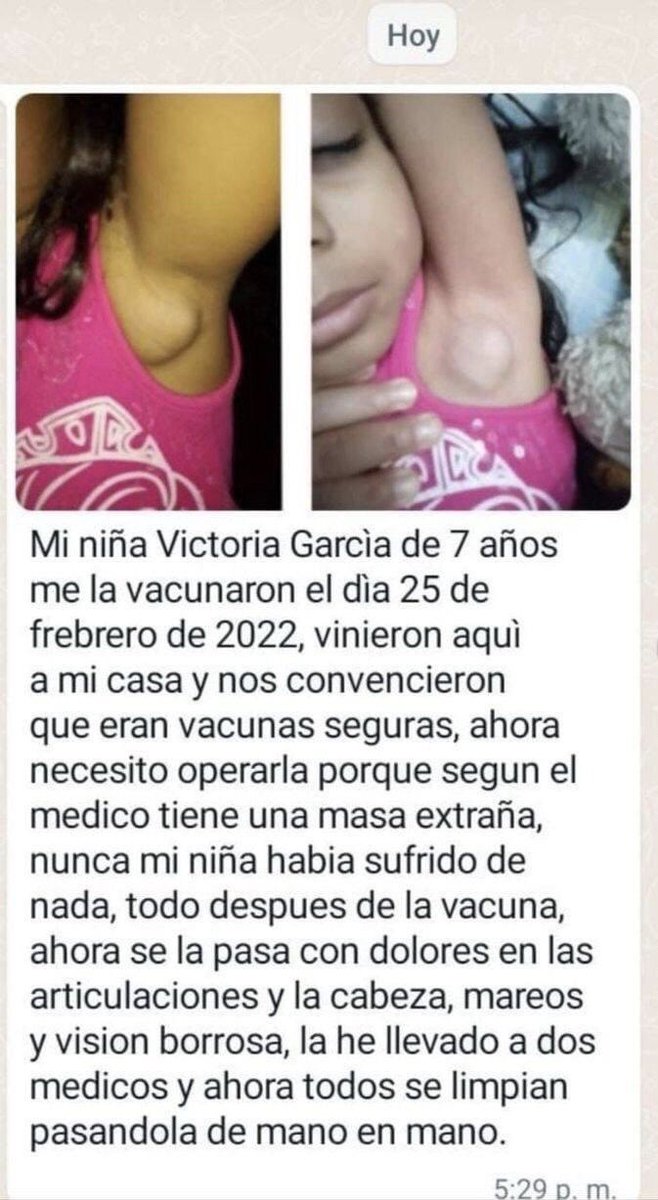 RSSol64860963's tweet photo. Esto está causado por la vacuna milagrosa!! Hay miles de casos como estos y es una niña! https://t.co/51zIEh1ndO