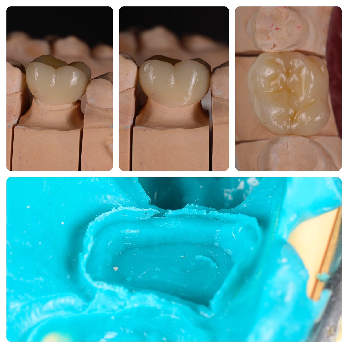 06 MAR 2022 
Happy National Dentist’s Day 🦷💙

instagram.com/p/CaxqkgfI9WV/…