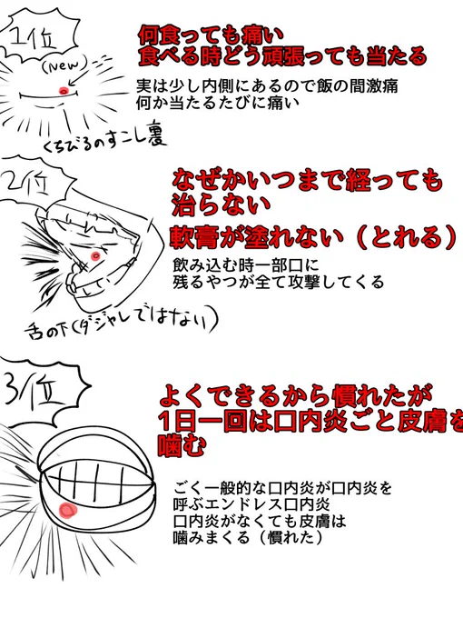 口内炎ができて辛かった、または現在進行形で辛い場所ランキング 