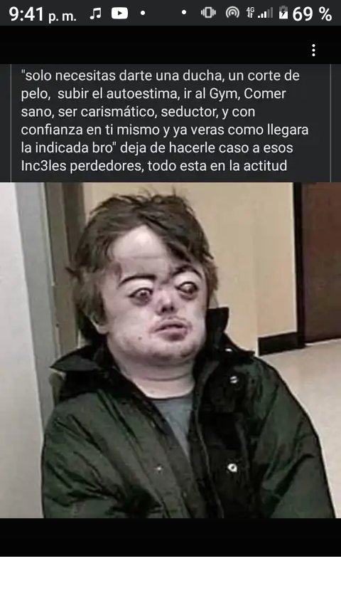 UnIncel's tweet image. Claro que si campeon