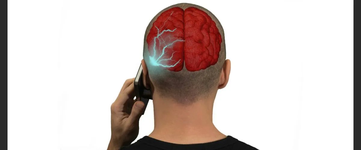 Hpathy's tweet photo. “The authors report on the association between vestibular schwannomas and mobile phone use. The factors of tumor volume and degree of phone use, as well as tumor location and frequently used ear are found to coincide.” https://t.co/g0sJOqzNlW https://t.co/qTaHfsDNkA