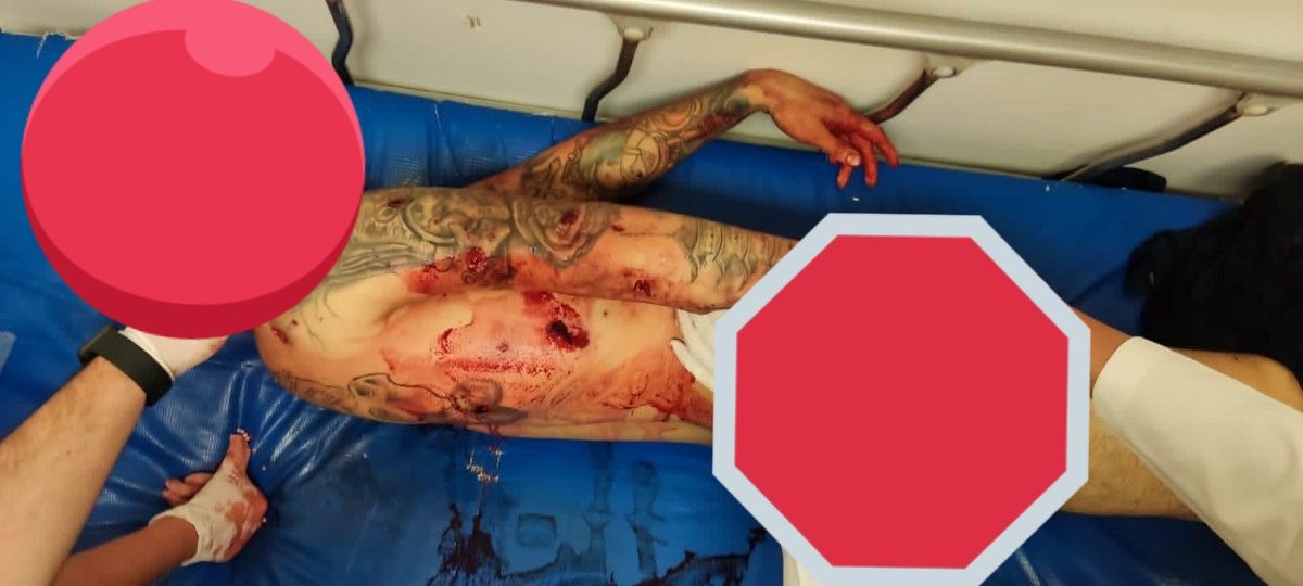 Pilingas11's tweet photo. @martinolimx No va a pasar nada, si a más de 24 horas siguen con que no hay muertos, quieren tapar el sol con 1 dedo señor Martinoli https://t.co/eFWseSCoIa