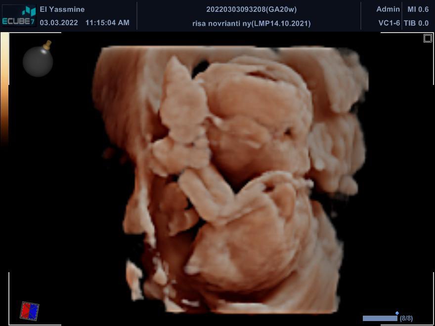 asirnvrynt's tweet photo. Haluuu my babyyyyy, 4 bulan lagi kita ketemu yaaah, semoga kita sehat-sehat dan kuat terus ya babyyyy 🥰👶🏻 https://t.co/ajBQVemcln