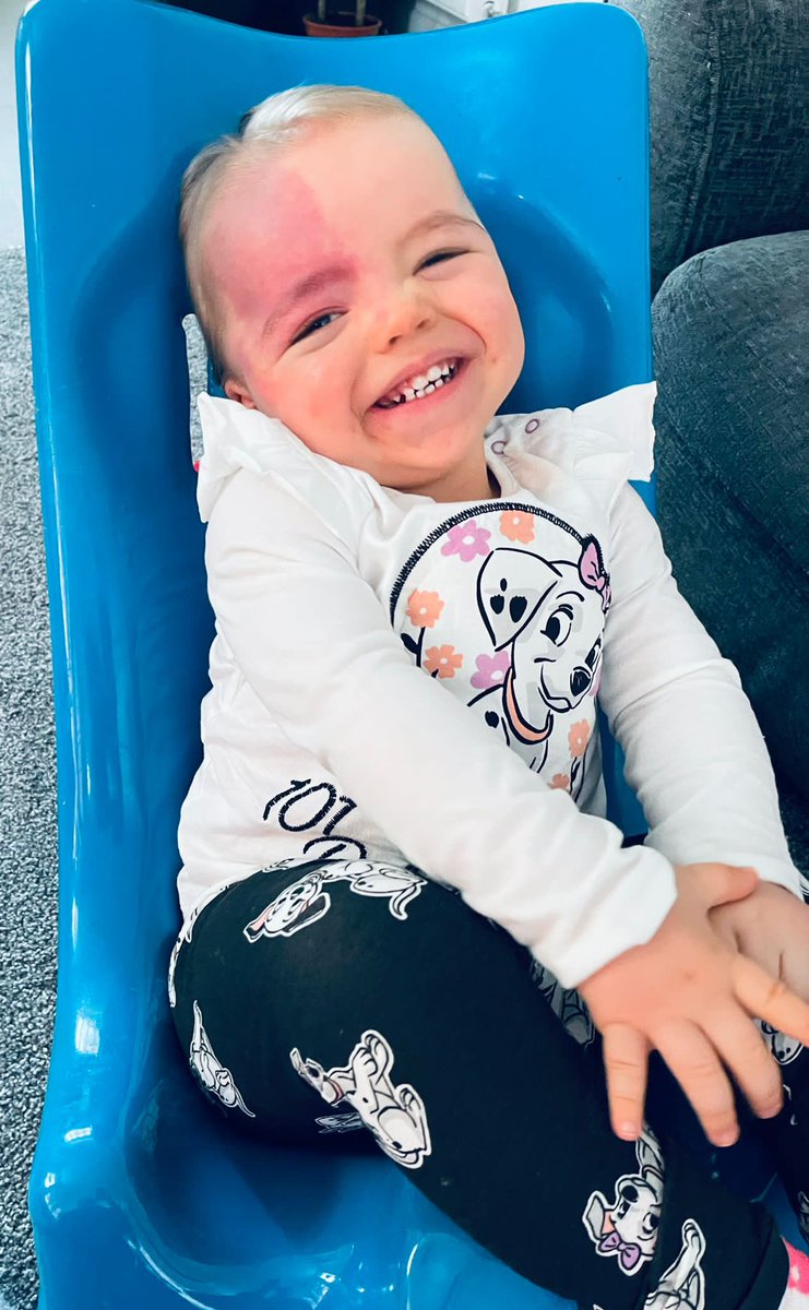 mikewoodman9's tweet photo. She still faces many challenges along the way, but the simple fact is without the NHS and Great Ormond Street she wouldn’t be here and for that we are forever grateful #NHS #GOSH #Eplilepsy #SturgeWeber #Beautifullymarked #brainsurgery https://t.co/J14S1Bj4vP