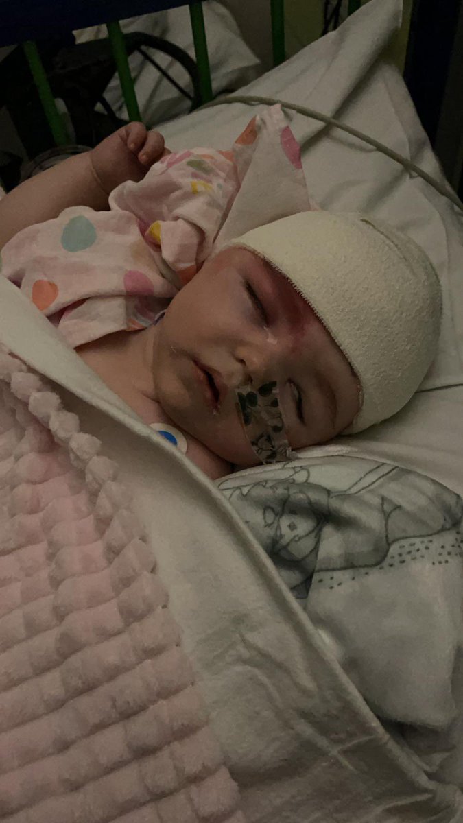 mikewoodman9's tweet photo. She still faces many challenges along the way, but the simple fact is without the NHS and Great Ormond Street she wouldn’t be here and for that we are forever grateful #NHS #GOSH #Eplilepsy #SturgeWeber #Beautifullymarked #brainsurgery https://t.co/J14S1Bj4vP