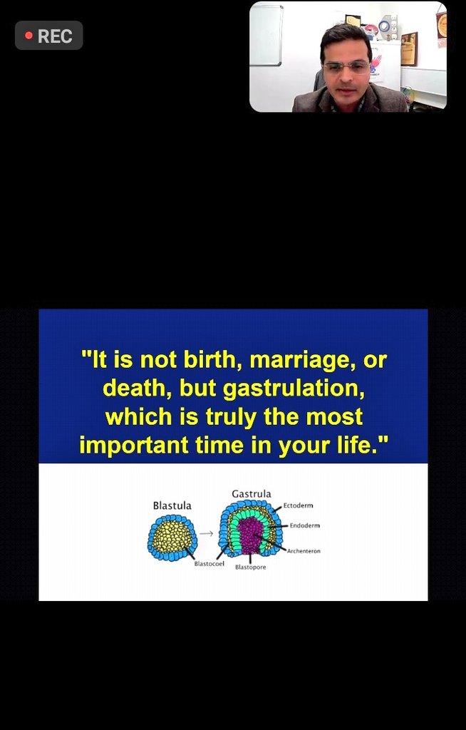 nihaal08's tweet image. Dr Kish Mankad @drmankad is live with spinal dysraphisms at the @theBSNR Pediatric Neuroimaging module.
Protocols Semantics Embryology clinics and Imaging..simplistic but effective approach to complex disorders..
@harshita_mv