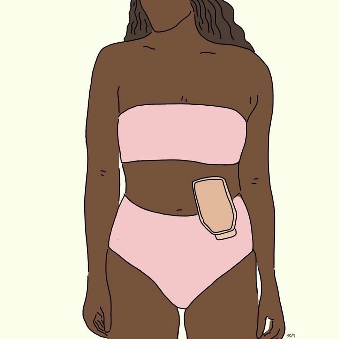 illnesslikeme's tweet photo. A babe with an ostomy bag
A babe who takes anxiety meds
A babe with Graves’ disease 
A babe with systemic Lupus 

Keep you the good work👏🏽 https://t.co/qbG6osbSut