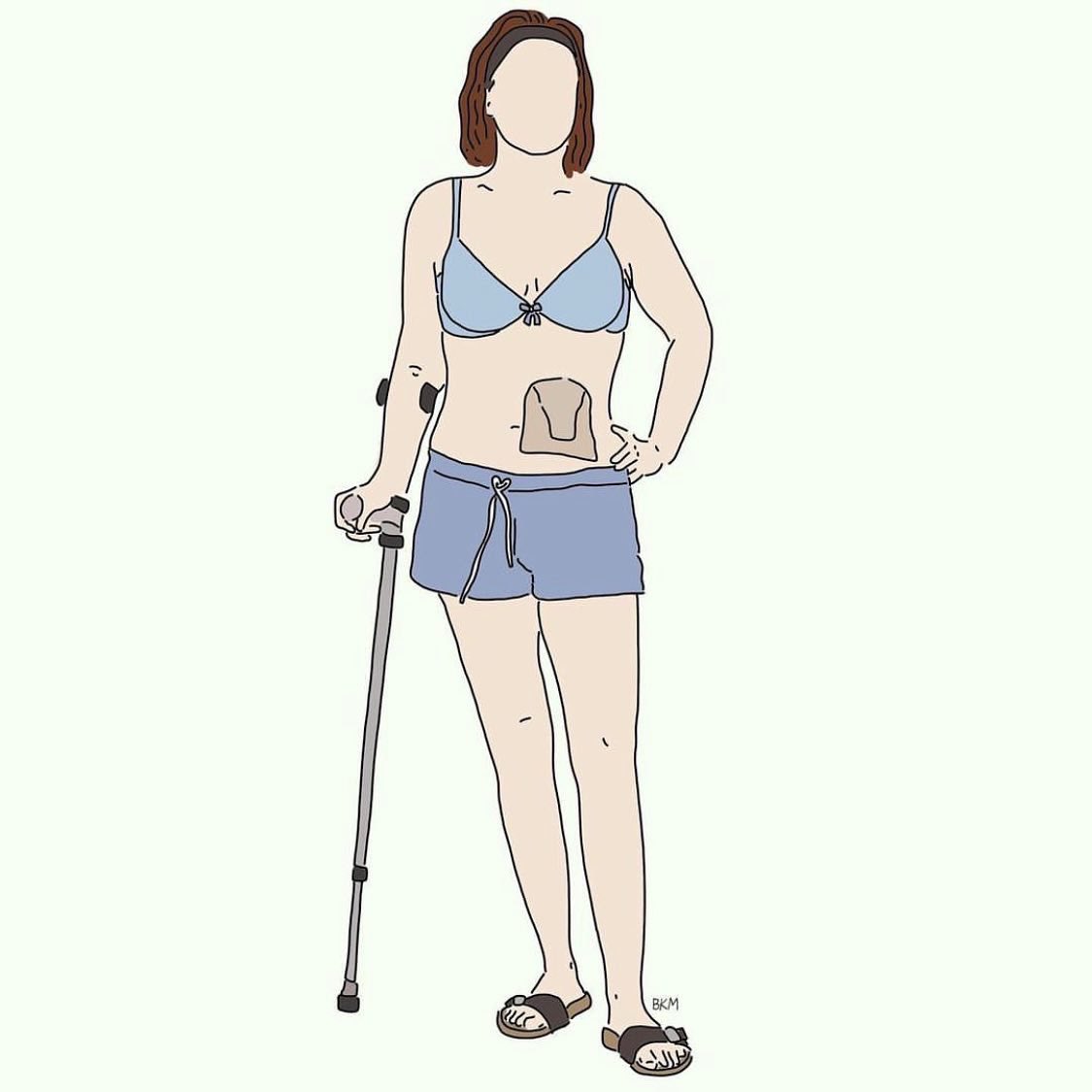 illnesslikeme's tweet photo. A series celebrating intersectional beauty of babes from different backgrounds and experiences by @handsomegirldesigns 

A babe with a feeding tube, EDS and a colostomy bag, an invisible Illness and bulimia. 

Oh, you assume I’m healthy because of the way I look?! https://t.co/NXWOWHmuja