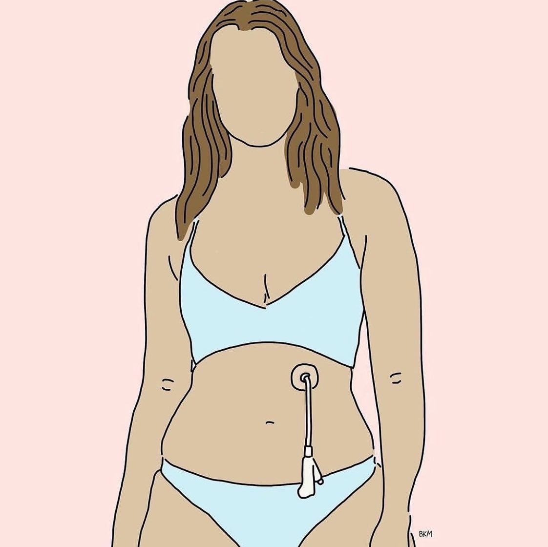 illnesslikeme's tweet photo. A series celebrating intersectional beauty of babes from different backgrounds and experiences by @handsomegirldesigns 

A babe with a feeding tube, EDS and a colostomy bag, an invisible Illness and bulimia. 

Oh, you assume I’m healthy because of the way I look?! https://t.co/NXWOWHmuja