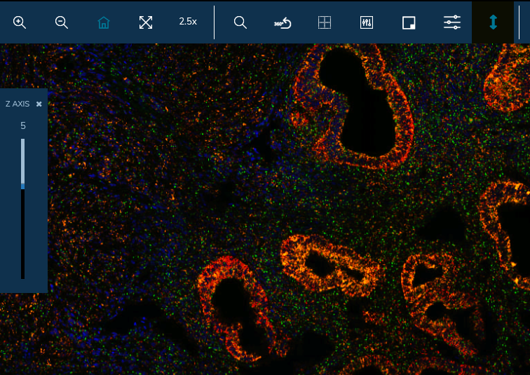 The adoption of DICOM standard for the development of the HUTER platform will help not only to overcome incompatibility barriers, but also to facilitate the compatibility and adoption of images in hospitals in the future.
Learn more: bit.ly/34imYxs

 #EU_HaDEA #HUTER