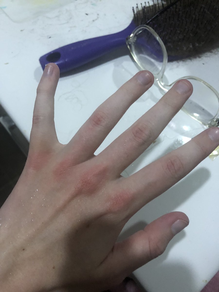 this_is_a_vent's tweet photo. Anger issues man https://t.co/fYhVxpr0ph