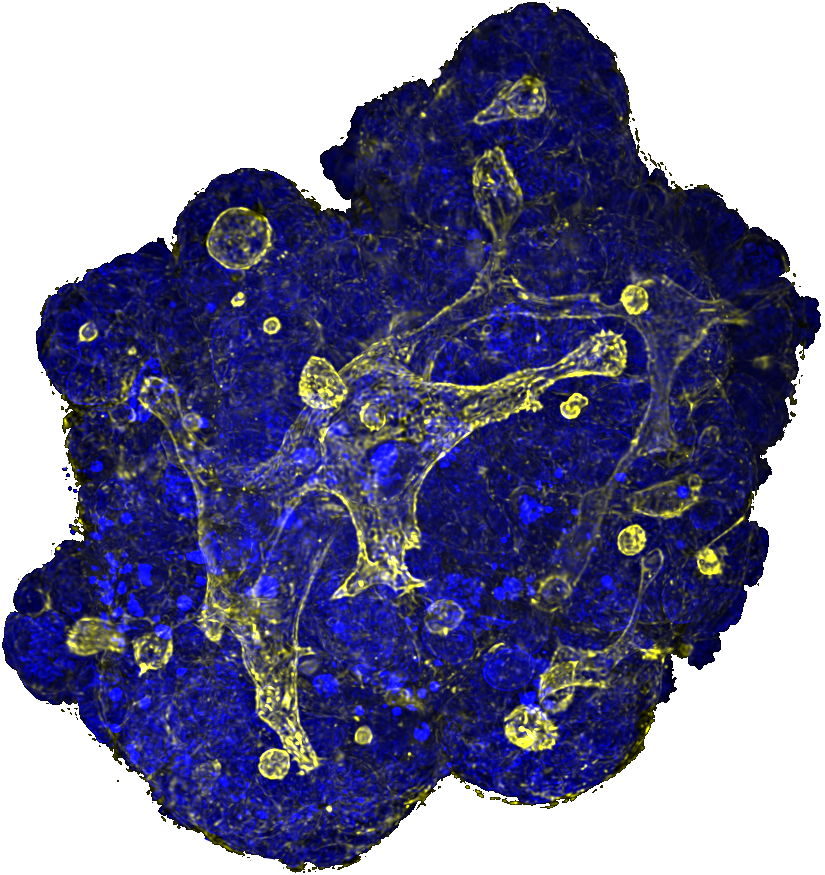 <a href="/Cellesce/">Cellesce</a> celebrates its ground-breaking #Organoid production #Patent family EP34819452 grant.  Our #IP_Portfolio grows with 2 other families filed and a 4th imminent. This confirms ownership of this industrial,  high-quality organoid production process.