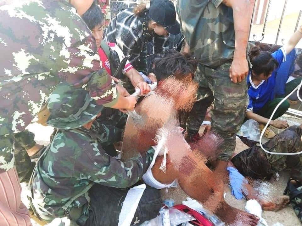 MoeeMyint's tweet photo. SAC Terrorists has conducted air strike in Demoso Township in Kayah State yesterday at 3:37 pm, on 06 March, leaving one dead and three badly wounded.   #MassacreInMyanmarByJunta #2022Mar7Coup #WhatsHappeningInMyanmar https://t.co/s49AbXLpzY