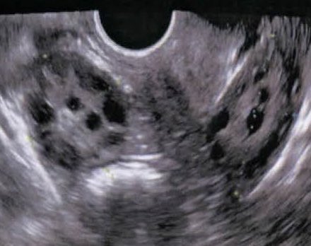 centroinfem's tweet photo. Reserva ovárica se llama a la cantidad de óvulos que una mujer pueda tener, ya que los óvulos no se reproducen 😳 😮 😮 

#fertilidad https://t.co/mptxuYvQoO