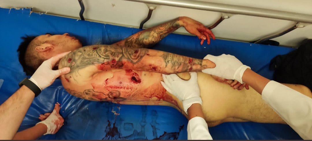 JorgeMe01115506's tweet photo. @Pilingas11 @martinolimx Si el sujeto no está muerto entonces tiene el sueño muy pesado.
Ese hoyo en el costado por el que se desangró ya los paramédicos no vieron razón para suturarlo... https://t.co/XTPzq1aKyS