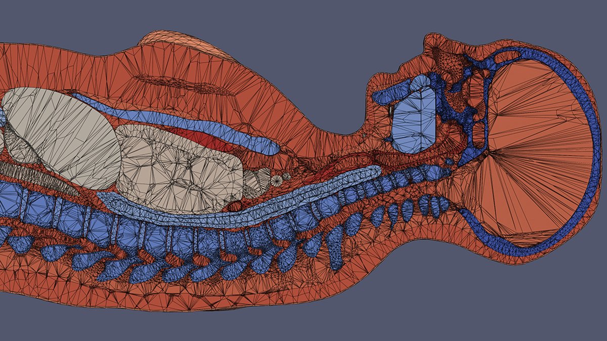 LSU's tweet photo. Students in the LSU SpaRTAN medical physics lab are using physics, biology, art and high-performance computing to create 3D replicas of human bodies that can be used for medical research without having to experiment on human beings. 

Learn more: https://t.co/9xndCF7BvH #LSUWorks https://t.co/kh7f6F2Nr0