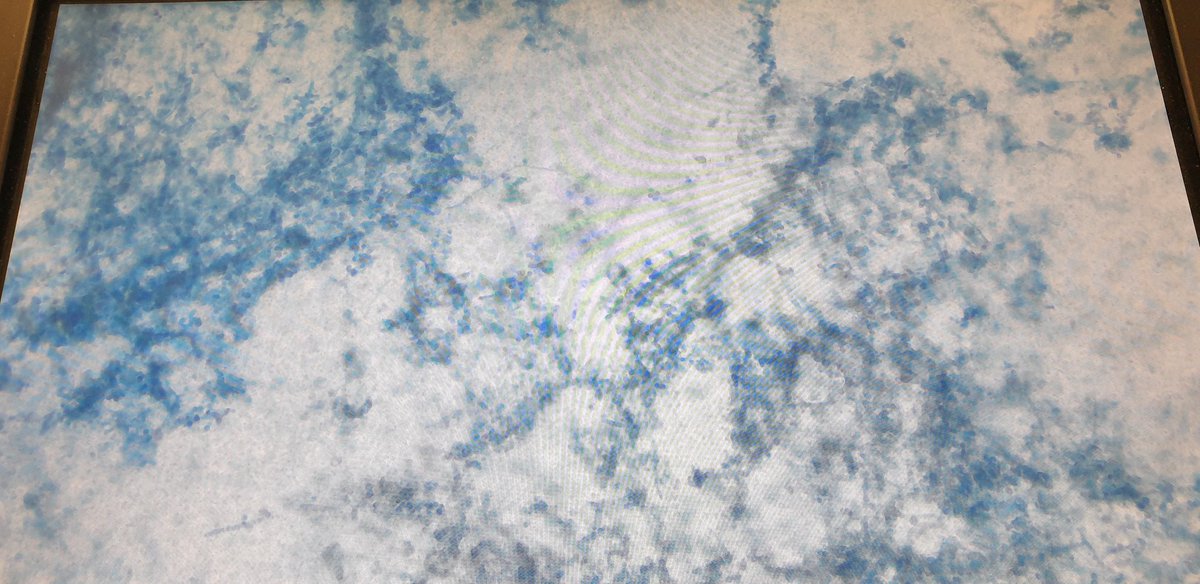 Yuck what happened to my foods today? How food wrapping affect spoilage? Let s use lactophenol cotton blue for our Food Science practical and identify different type of food spoilage <a href="/UoR_LifeScience/">UR Life and Health Sciences</a> <a href="/NutritionRoe/">Nutrition@Roehampton</a> <a href="/ClinicalMsc/">MSc Clinical Neuroscience</a> <a href="/csaoris/">Carolina Saori Mauro</a> <a href="/adele759/">Adele Costabile</a>