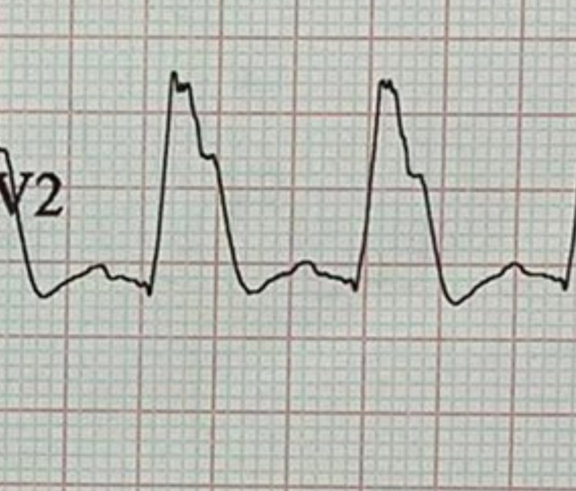Brooks Walsh tweet media