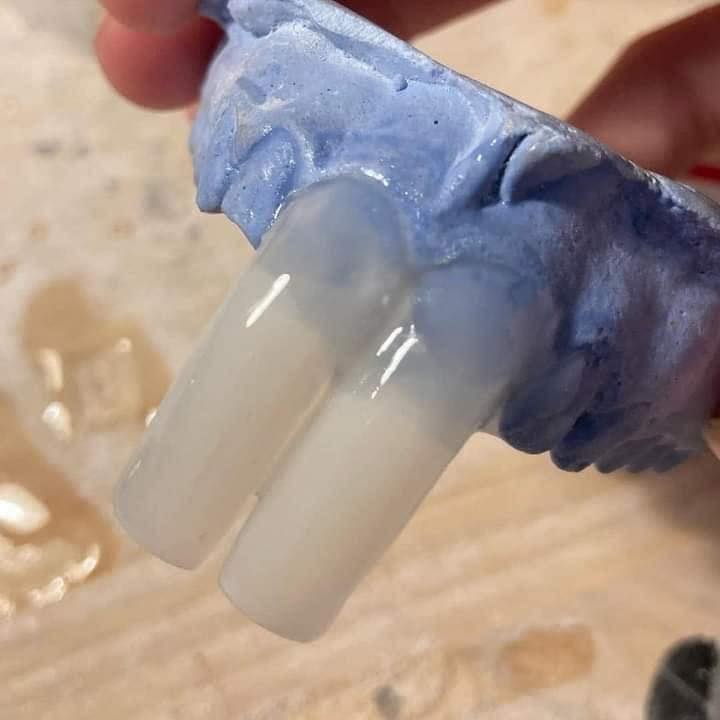 Tvmos_'s tweet photo. #Increíble ¡La nueva moda dental! 😱 ¿Te pondrías estas prótesis en los dientes? 🤔

#SquirrelTeeth https://t.co/Y48omUJhH7