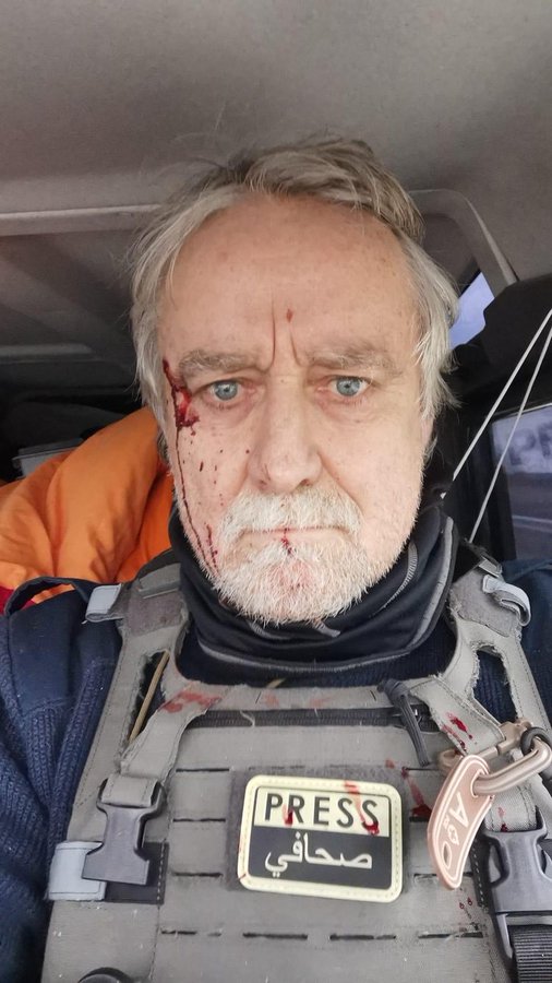 Status7News's tweet image. „Au împușcat clar pentru a ucide”: fotoreporterul elvețian Guillaume Briquet a scăpat de gloanțe ieri, trase de un comando rus pe o șosea din sudul Ucrainei. Marcajele „presă” erau clar vizibile pe mașina lui. 1/2