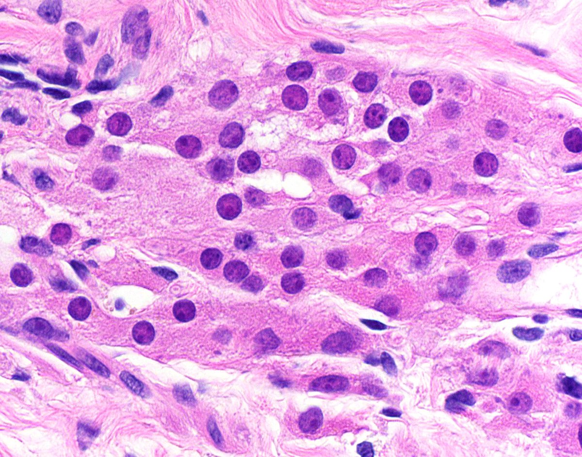 IHC_guy's tweet photo. We're long overdue for another installment of "Andrew gets overly excited about normal histology."
Can any #PathCurious med students and/or R1s (or full professors, for that matter) tell me the provenance of these pink polygonal cells??? https://t.co/JXe98XTXYb