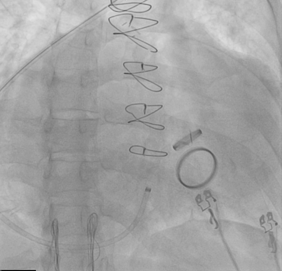 Kris Heinzman tweet media