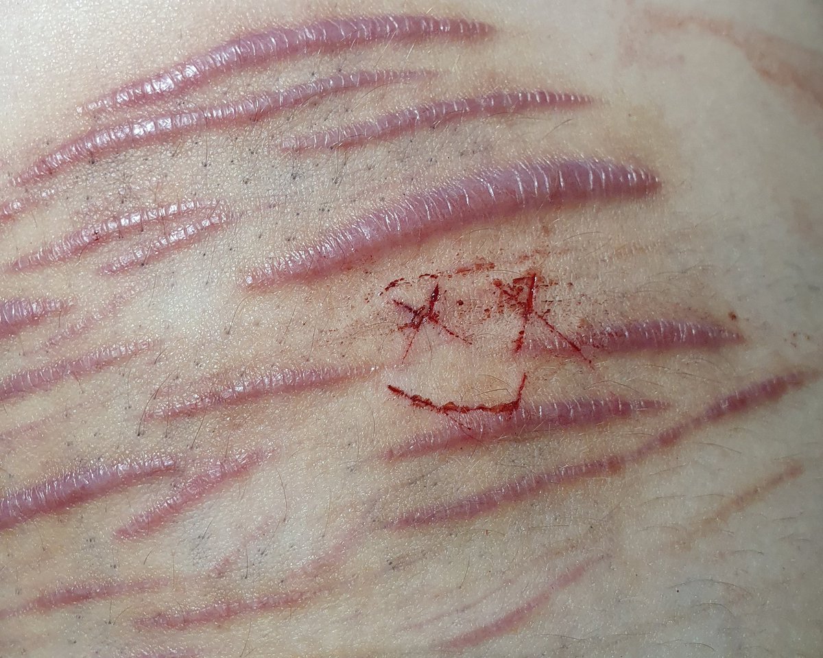 lavalampbl00d's tweet photo. from last night. also drew a little face.
-
-
beanstwt barcodetwt yeettwt sliceytwt catscratchtwt armgillstwt ouchietwt styrotwt https://t.co/vlkcVC8knN