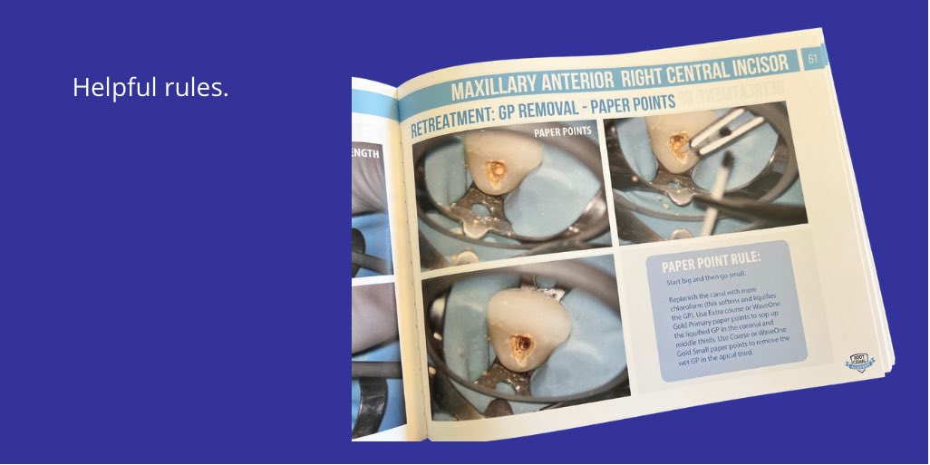 I’m very happy to announce release of my Ultimate RETX Master Playbook. Available now on the Root Canal Academy website. Link in bio. Here’s a taste…