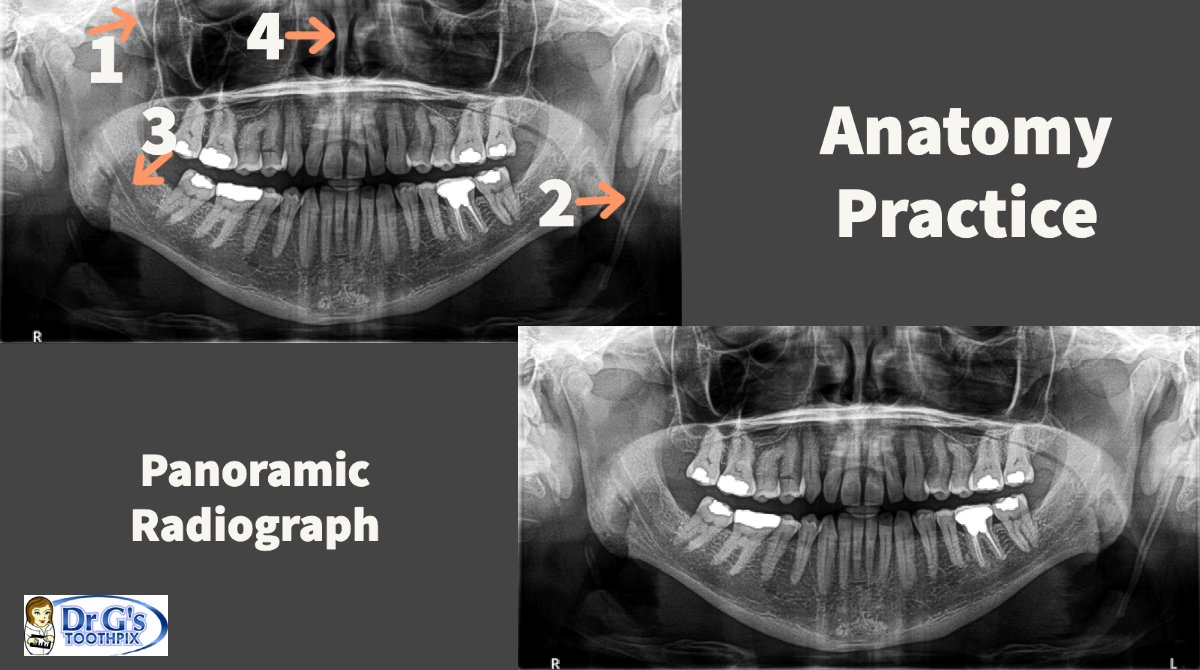 Anatomy Practice
More panoramic radiograph
Answers coming later today